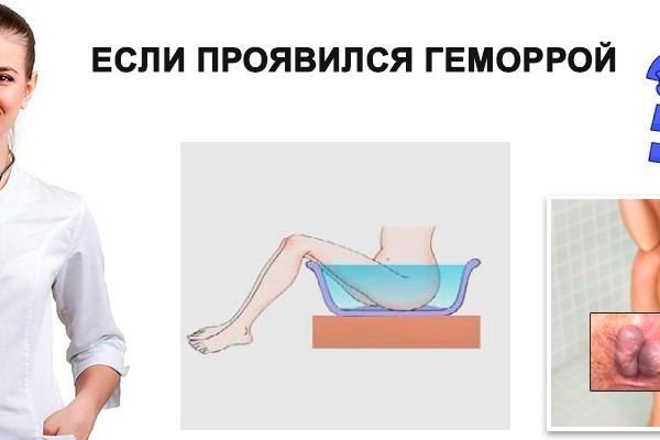 Kraken russia